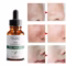 Melao Tea Tree Oil